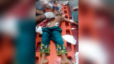 عکس تلخ از کودک مجروح شده بلوچ در حمله تروریستی
