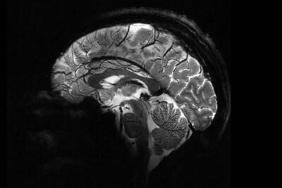 تصاویر مغزی ثبت‌شده توسط قوی‌ترین دستگاه MRI جهان