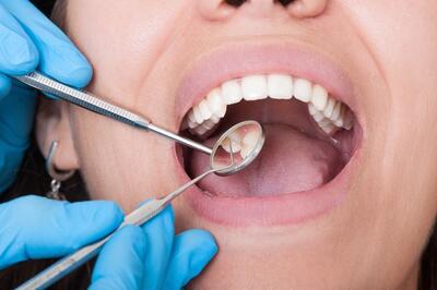 شناسایی رابطه جدی بین بهداشت دهان و دندان و سرطان کشنده | خبرگزاری بین المللی شفقنا