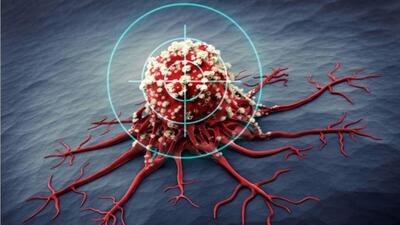 استفاده از نانو حامل دارورسان برای کاهش عوارض دارو‌های ضدسرطان