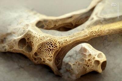 اینفوگرافیک/ ۶ واقعیت علمی در مورد پوکی استخوان