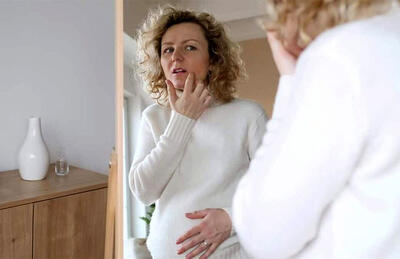 دلایل جوش زدن در بارداری + درمان