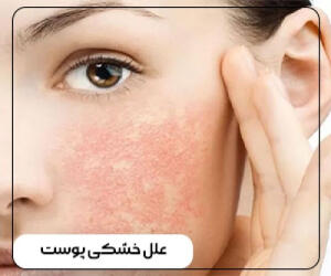 علل خشکی پوست و موثرترین راه های درمان آن