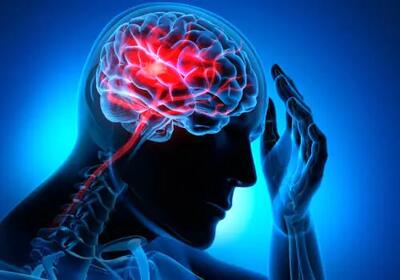 چگونه می‌توان از سکته مغزی جلوگیری کرد؟| درمان سکته مغزی چیست؟
