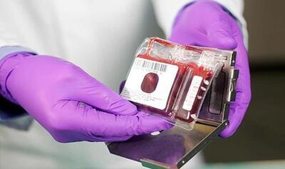 ذخیره‌سازی ۲۲۰ نمونه خون بند ناف در استان مرکزی
