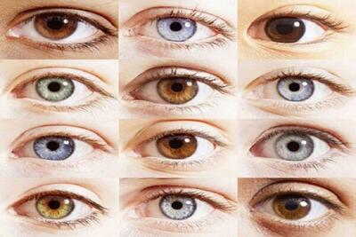 اطلاعاتی درباره تغییر رنگ چشم و کاشت نگین
