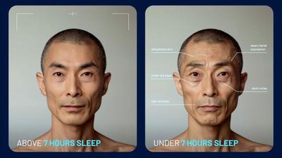 اگر ۷ ساعت خواب نخوابید، صورت شما این شکلی می‌شود