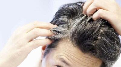 فواید روغن سیاه دانه برای رفع سفیدی مو