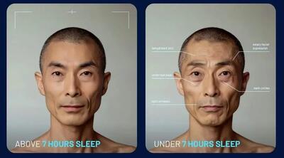 اگر ۷ ساعت نخوابید، صورت شما این شکلی می‌شود