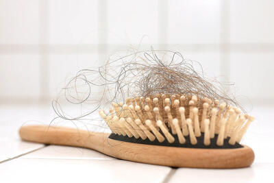 علت ریزش مو در زنان کمبود چه ویتامینی است ؟ | دلایل ریزش مو در زنان
