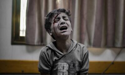 یونیسف: از ابتدای جنگ غزه حدود ۱۲ هزار کودک آسیب دیده‌اند