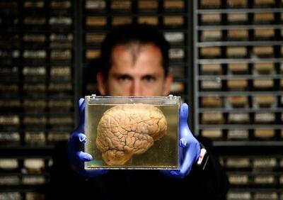 پولداری بر مغز چه تاثیری می‌گذارد؟
