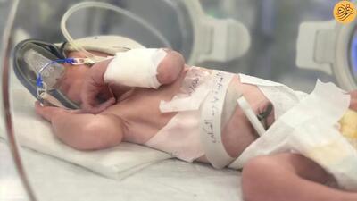 وضعیت نوزادی که از شکم مادر مرده‌اش متولد شد + عکس