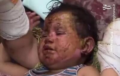فیلم/ زخمی شدن کودک فلسطینی در اردوگاه البریج (۱۳+)