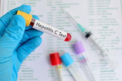 «درمان هپاتیت سی در کشور رایگان شد» | پایگاه خبری تحلیلی انصاف نیوز