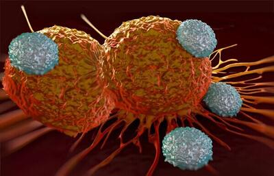 دانشمندان: برخی رژیم‌های غذایی به کاهش رشد تومورهای سرطانی کمک می‌کنند