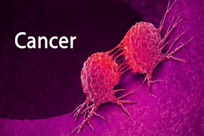 آمار عجیب ابتلا به سرطان روده درایران