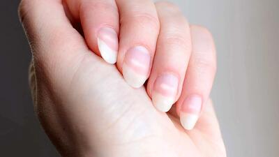 لکه‌های سفید روی ناخن‌ها: از کمبود ویتامین تا علل جدی‌تر