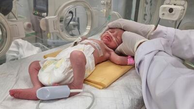 نوزاد فلسطینی نجات یافته از مادر جان‌باخته درگذشت