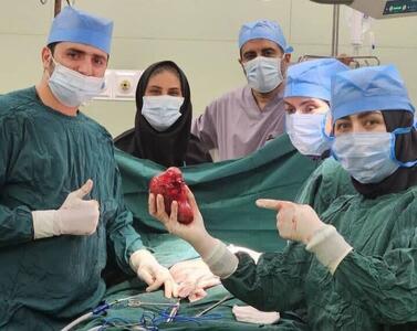 خروج تومور ۱۴ سانتی از کلیه کودک بندرعباسی توسط تیم پزشکی