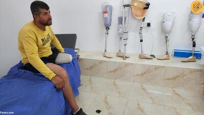 (تصاویر) دست و پای مصنوعی برای مردم غزه