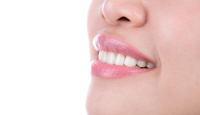 از بین بردن فوری زردی دندان با 5 روش ساده و دم دستی + از خندیدن خجالت نکش!