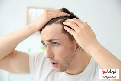 9 روش موثر برای جلوگیری از ریزش مو در مردان