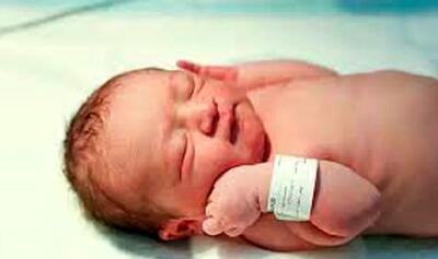 وحشتناک ترین نوزاد دنیا به دنیا آمد+ عکس