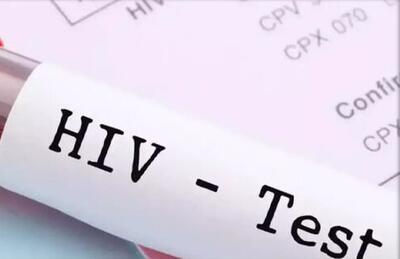 HIV را می‌شود به صورت طبیعی درمان کرد؟
