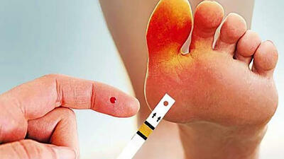 چرا دیابتی ها در معرض خطر قطع پا قرار دارند؟