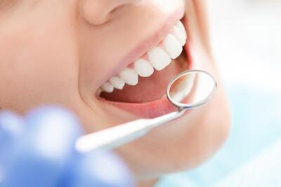 ارزش دندان‌های شما چقدر است؟