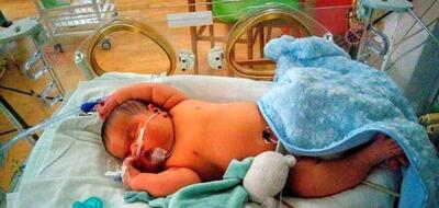 تولد نوزاد سنگین وزن در میاندوآب+ عکس