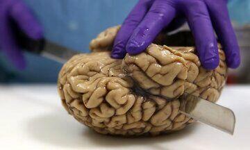 (تصاویر) جزئی‌ترین تصویر از مغز انسان که تابه‌حال دیده‌اید!