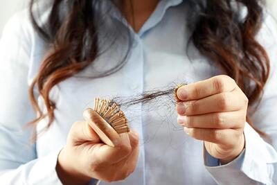 بهترین درمان ریزش مو در زنان که باید بدانید! ۶ روش درمانی