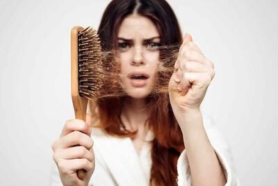 ریزش مو سر را سه سوته درمان نکنید - اندیشه معاصر