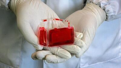 افزایش ۱۲ درصدی ذخیره خون بند ناف در البرز