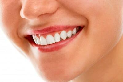 ۱۰ راز سفید کردن دندان‌ها در خانه