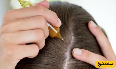 3 روغن طبیعی که به تسریع رشد مو کمک می‌کند