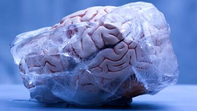 محققان چینی مغز منجمدشده انسان را دوباره زنده کردند
