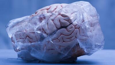 محققان چینی مغز منجمد شده انسان را دوباره زنده کردند