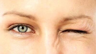 6 علت علمی پرش پلک چشم