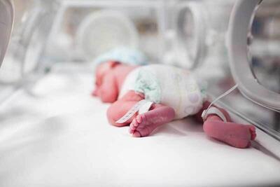 نوزادان نارس در معرض ابتلا به «بیماری هیدروسفالی»