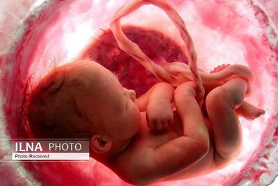 جلوگیری از سقط 405 جنین سالم در فارس