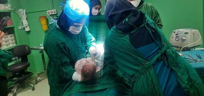 تولد اولین نوزاد از طریق روش آی وی اف در یاسوج