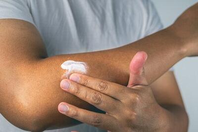برای استفاده از کرم ضد آفتاب به چه نکاتی باید توجه کرد؟