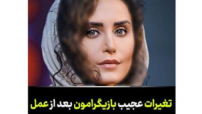 خانم بایگران ایرانی که با جراحی از این رو به آن رو شدند / فیلم تغییرات چهره که باور نمی کنید!