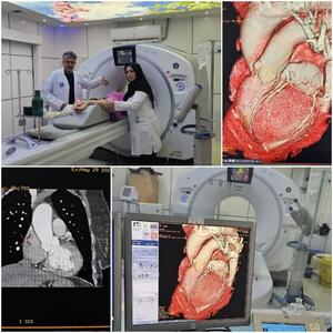 اولین سی تی اسکن آنژیوگرافی تاوی قلب در استان اردبیل انجام شد