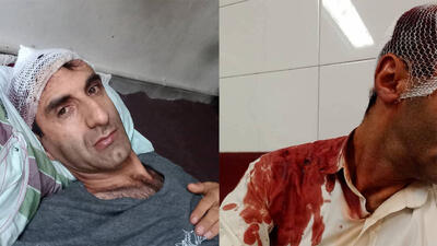 حمله وحشیانه 3 مسافر خشن به رانند تاکسی اینترنتی تهران + عکس های دلخراش