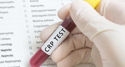 آزمایش CRP چیست؟ - روزیاتو