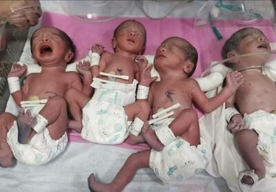 تولد چهارقلوهای مشهدی در هفته 33 بارداری + فیلم - تسنیم
